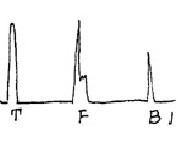 山东瑞祥试块 山东瑞祥试块